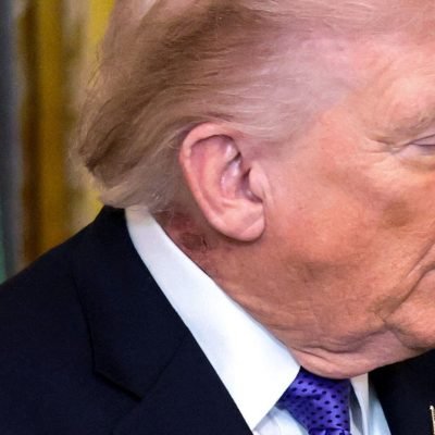 Trump says health check ‘perfect’ after scrutiny over rash